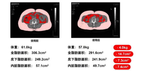 玫瑰果籽对脂肪起作用的相关数据