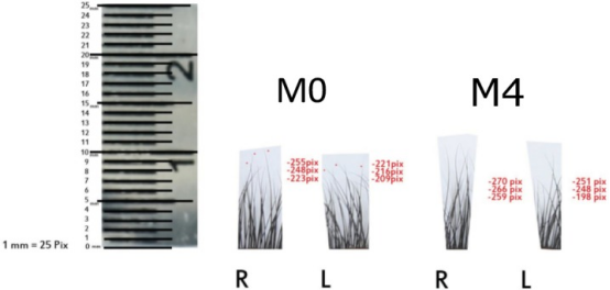 肉豆蔻酰五肽-4