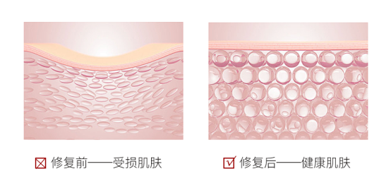 皮肤修复预防