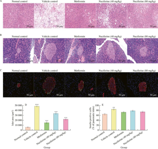 荷叶碱改善KK-Ay小鼠胰腺肝脏脂肪变性和胰岛肥大的作用