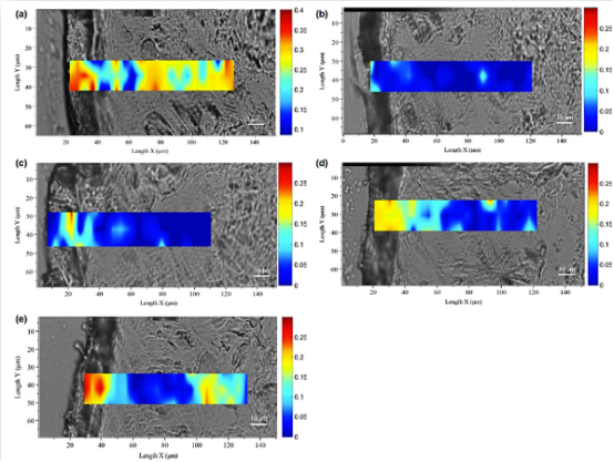 Hyaluronic acid (HA)