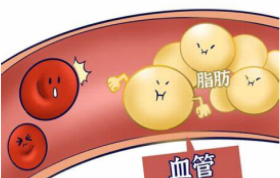 神经酸帮助降血脂