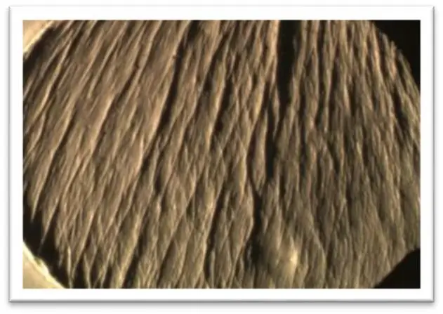 明显改善皱纹之添加前